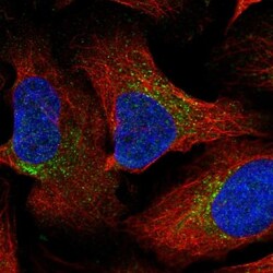Galanin Antibody, Novus Biologicals:Antibodies:Primary Antibodies